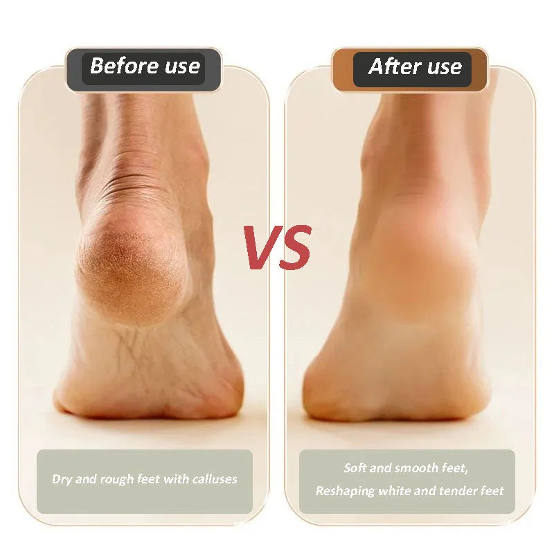 🔥2025 New Arrival💝New Digital Electric Foot Polisher