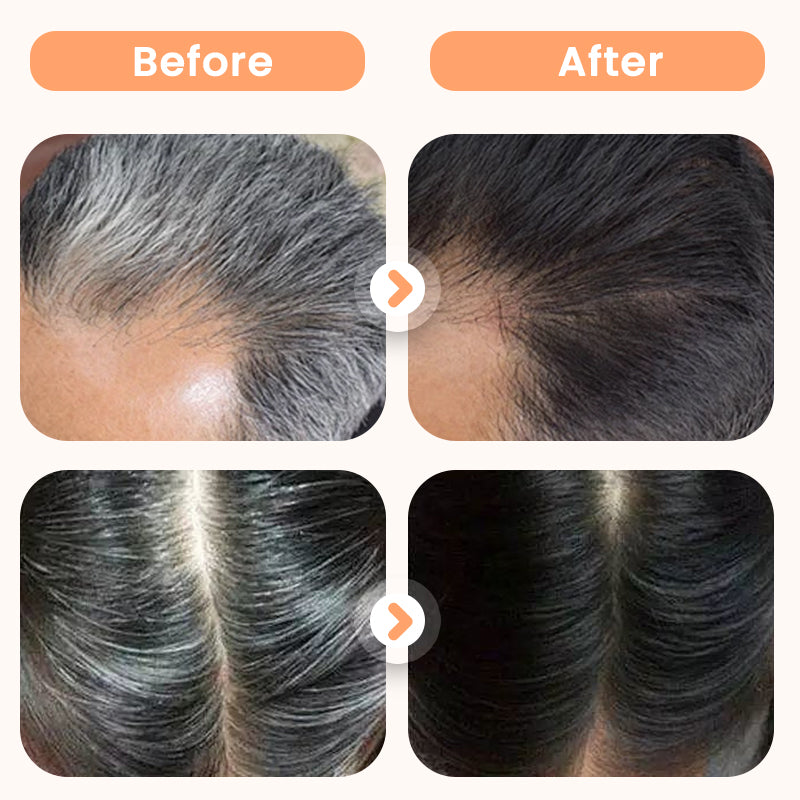 Plant Extract Hair Dye for Gray Hair