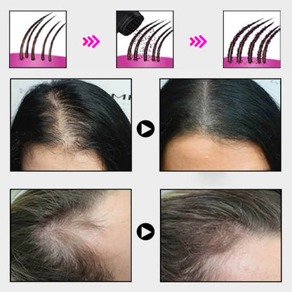 🔥BUY 1 GET 1 FREE💝Hair Thickening Hair Building Fiber Powder