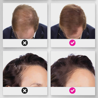 🔥BUY 1 GET 1 FREE💝Hair Thickening Hair Building Fiber Powder