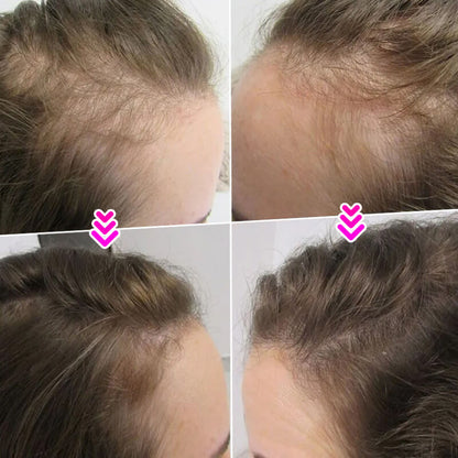🔥BUY 1 GET 1 FREE💝Hair Thickening Hair Building Fiber Powder