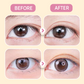 ✨Invisible Strong Support Double Eyelid Tapes for Enlarging Eyes