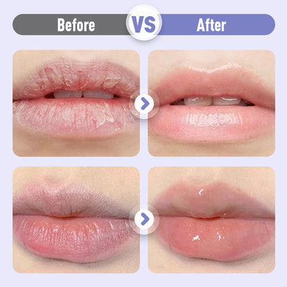 ✨ Buy 1 Get 1 Free✨ Plumping & Anti-Wrinkle Hydrating Lip Serum