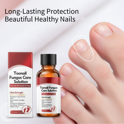 🔥Hot Sale-50%OFF!🔥🖤See Real Results Faster🖤2 bottles Nail Repair Essence for Damaged Nails💅🏻