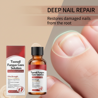 🔥Hot Sale-50%OFF!🔥🖤See Real Results Faster🖤2 bottles Nail Repair Essence for Damaged Nails💅🏻