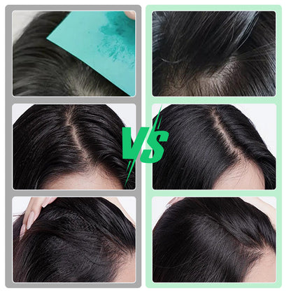 ✨ Volumizing Hold Spray – Effortlessly create full, bouncy hair with a fresh, silky-smooth feel all day long! ✨