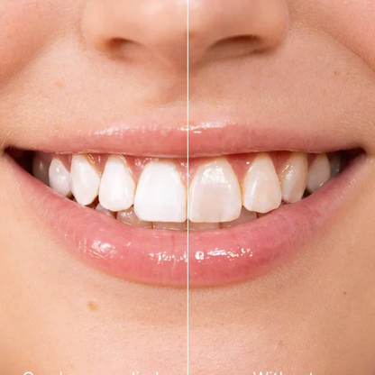 🏆2026 New Arrivals - 50% Off!🧴Instant Whitening Tooth Paint😁🦷