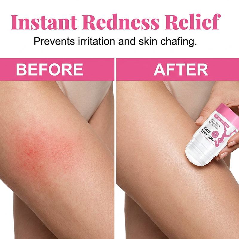 🛡️🏃 Anti-chafe balm – stops thigh rubbing, soothes skin, stays on all day!