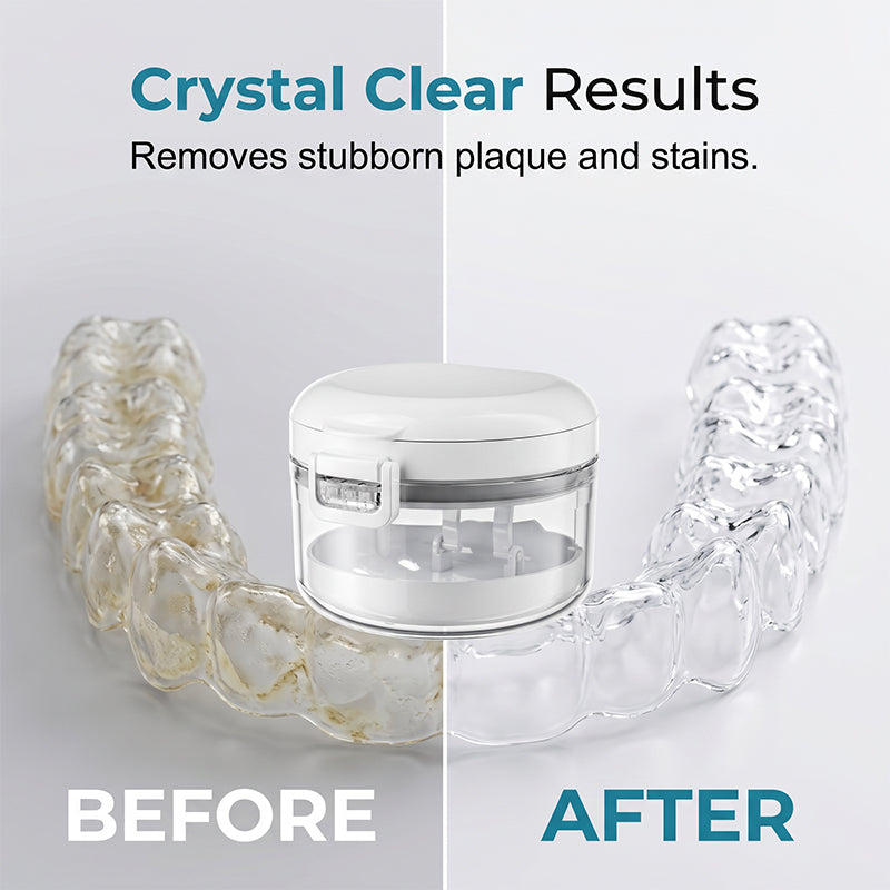 🦷Portable Magnetic Aligner Cleaning Case, Removable Retainer Storage Cleaner Box💧