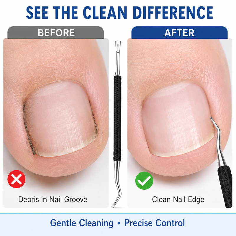 🔥Hot Sale 50% OFF🔥 Dual-Ended Toenail Lifter & Under-Nail Cleaner Tool – Professional Stainless Steel Nail Care Instrument, Lifts Nail Edges & Removes Debris, for Home Pedicure 🦶