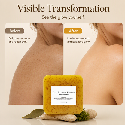 Lemon Turmeric Kojic Acid Soap